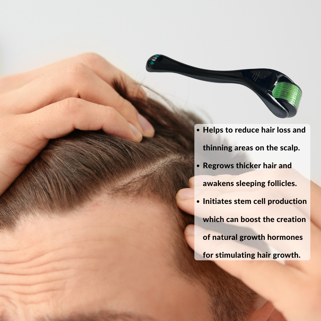 Caucasian man showing his scalp and annotation of benefits of dermarolling