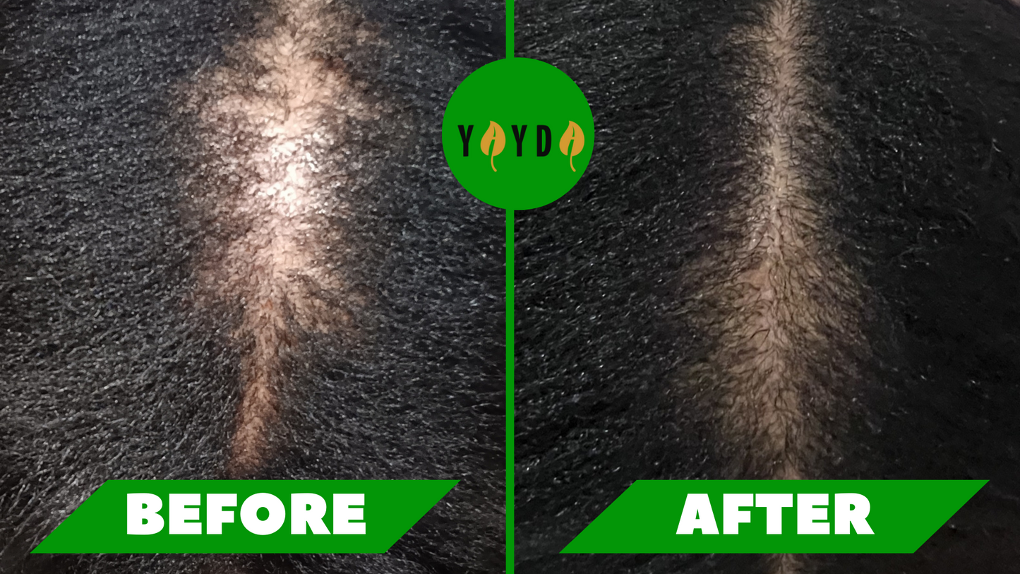 Before and after of customer's hair regrowth