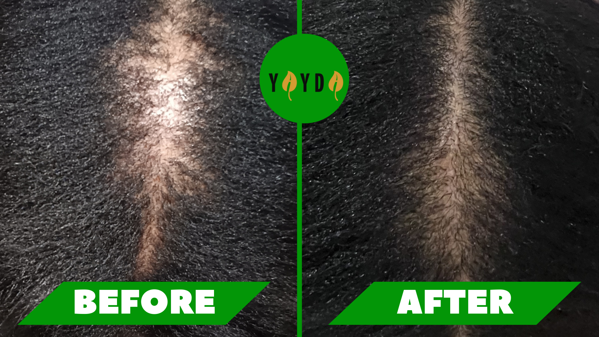 Before and after of customer's hair regrowth